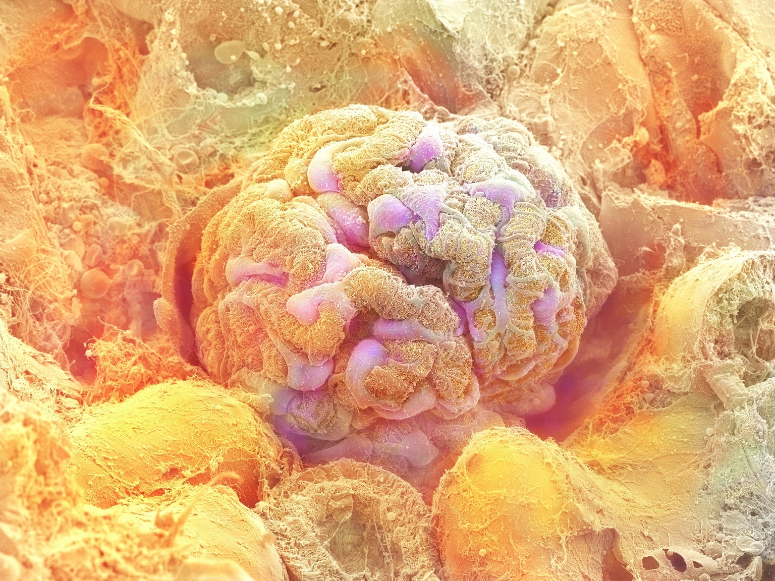 腎臓の糸球体 ©甲賀大輔・旭川医科大学/ 日立ハイテクノロジーズ/NHK