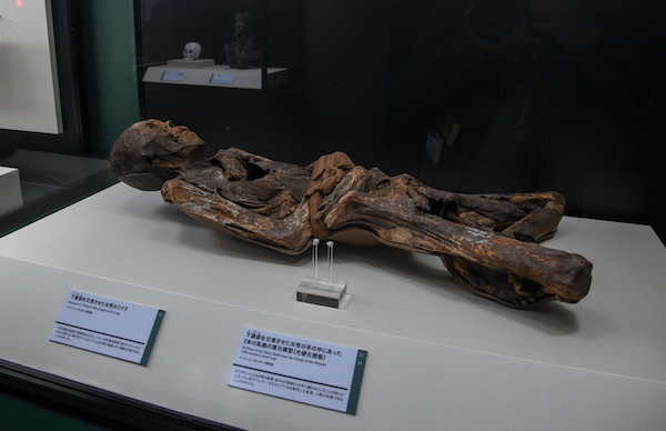手前／《下腹部を交差させた女性の手の中にあった2本の乳歯の復元模型（光硬化樹脂）》　奥／《下腹部を交差させた女性のミイラ》 ともに、ペルー中央海岸、先コロンブス期チャンカイ文化 1390年頃-1460年頃 ライス・エンゲルホルン博物館