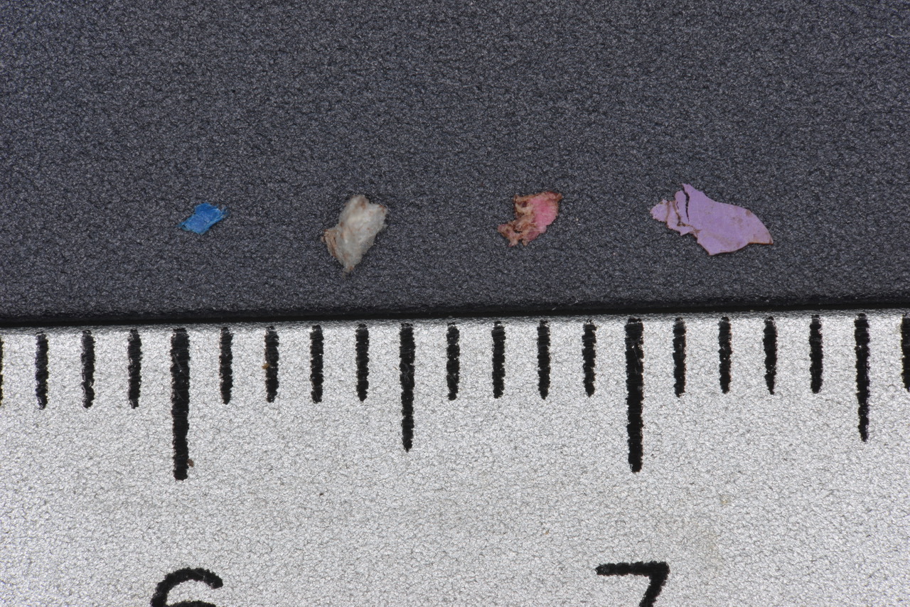 クジラの体内から見つかったマイクロプラスチック
